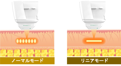 最新機器「LINEAR Z」