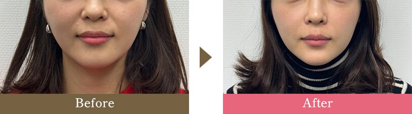 横浜青葉台院のピックアップ症例写真 1