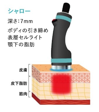 ポケット