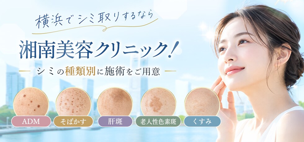 横浜でシミ取りなら湘南美容クリニック