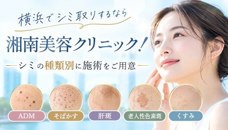 横浜でシミ取りなら湘南美容クリニック