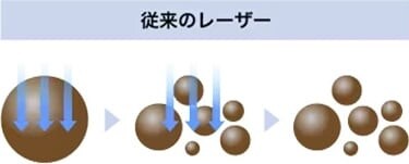 従来のレーザーによるメラニン色素の分解