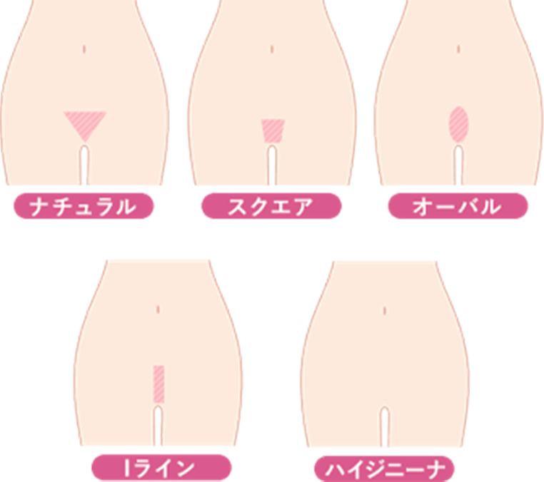 5つのデザイン