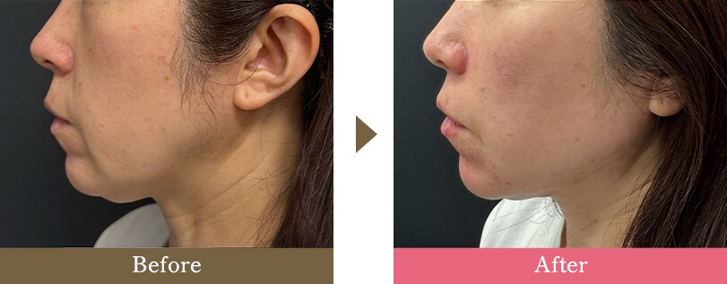 SBCスキンクリニック 岡山院のピックアップ症例写真 3