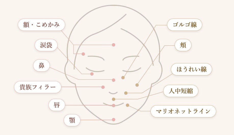 お悩みやご希望に応じて部位・製剤をカスタマイズ