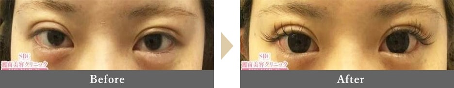 なりたかった可愛らしいタレ目に