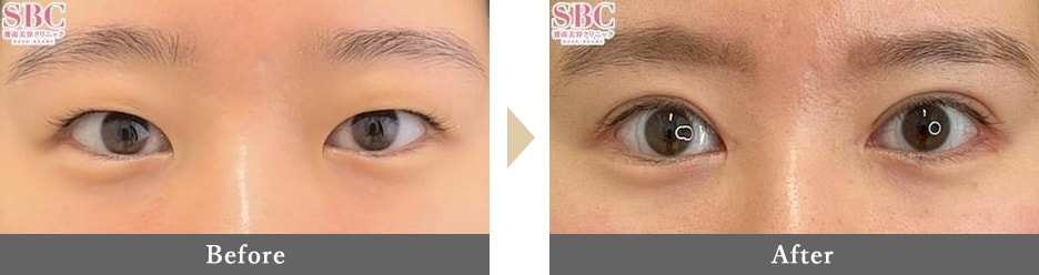 ツリ目気味を解消して明るい目元に印象アップ!