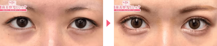 新里医師症例写真n293527