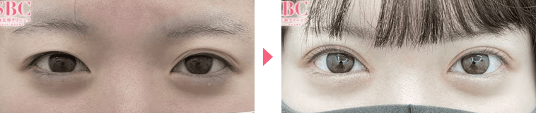 新里医師症例写真n302246
