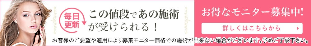 お得なモニター募集中！