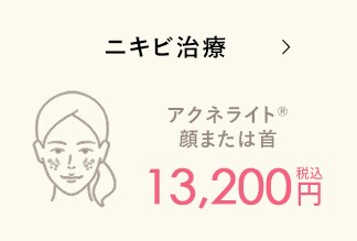 ニキビ治療