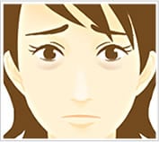 クマ取り+脂肪注入はこんな方におすすめ