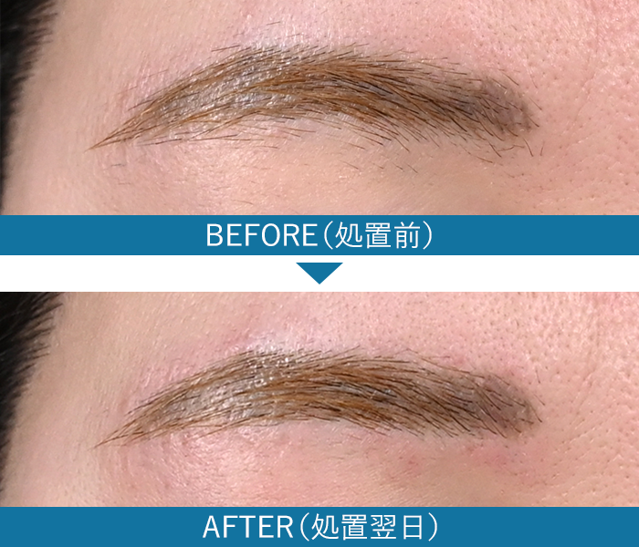 症例写真2