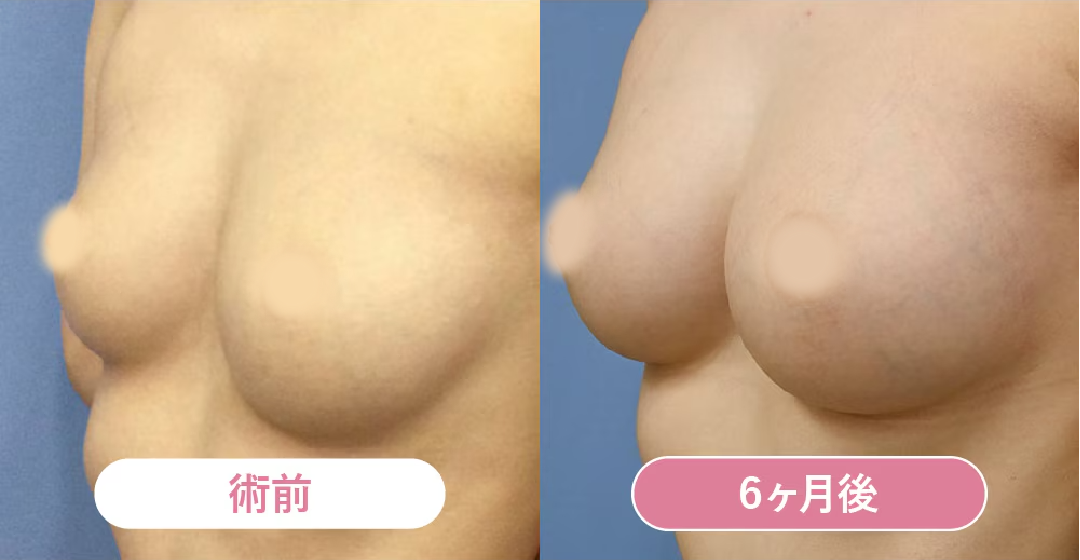 ベスト症例写真