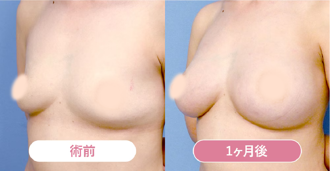 ベスト症例写真