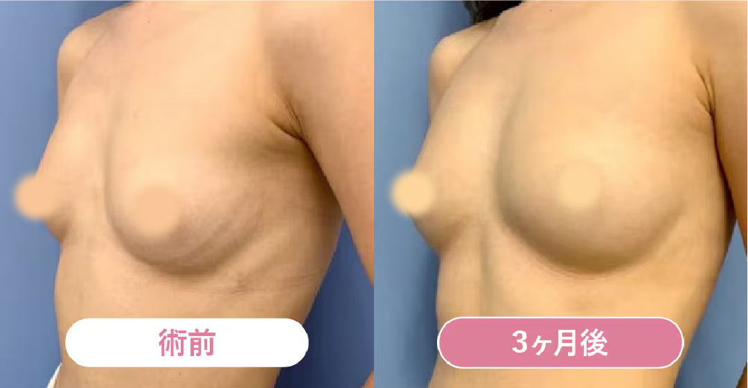 ベスト症例写真