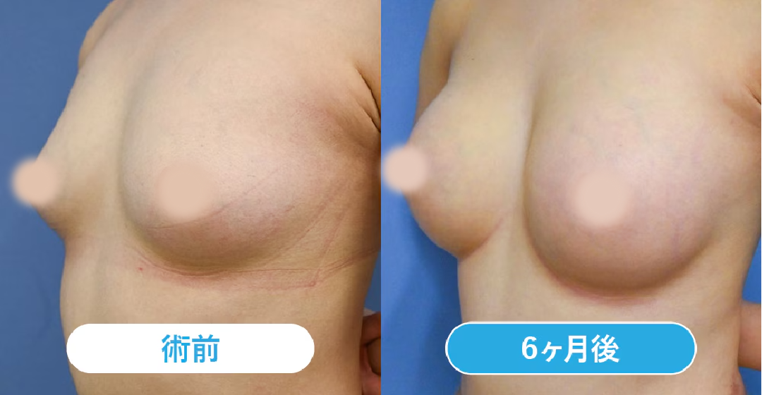 ベスト症例写真