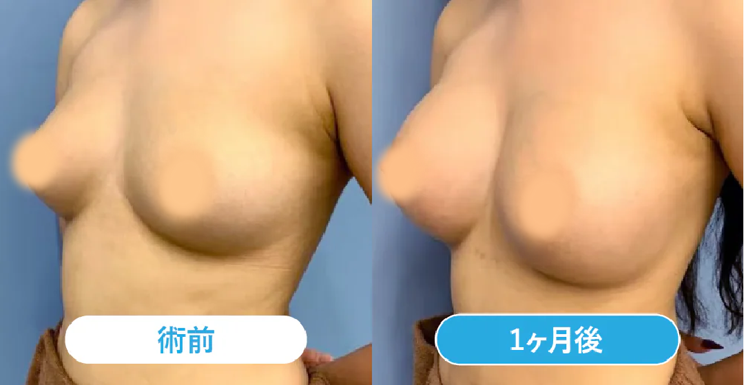 ベスト症例写真