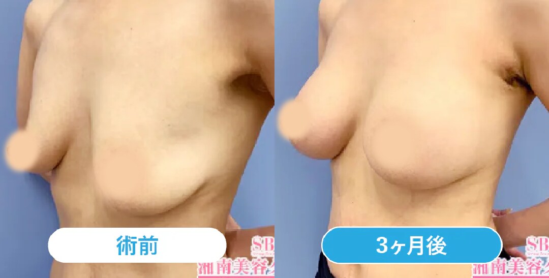 ベスト症例写真