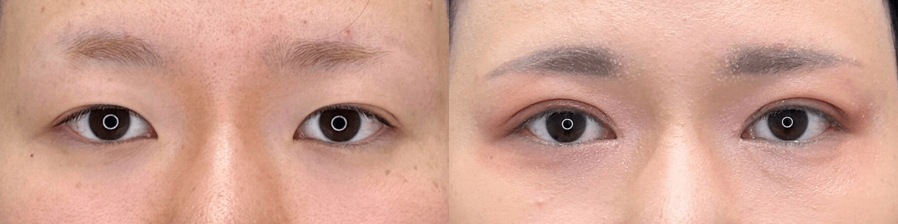 ベスト症例写真