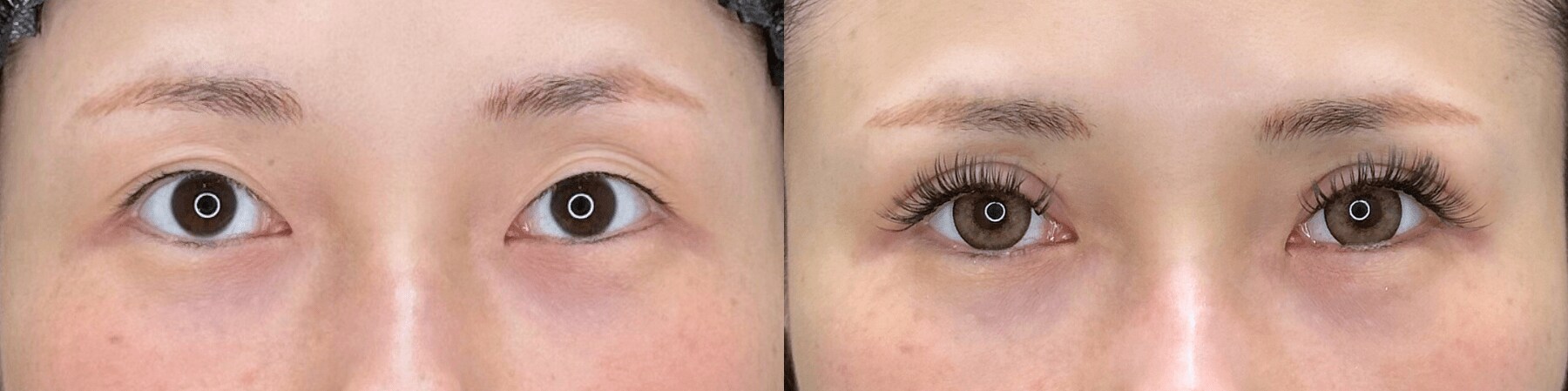 ベスト症例写真