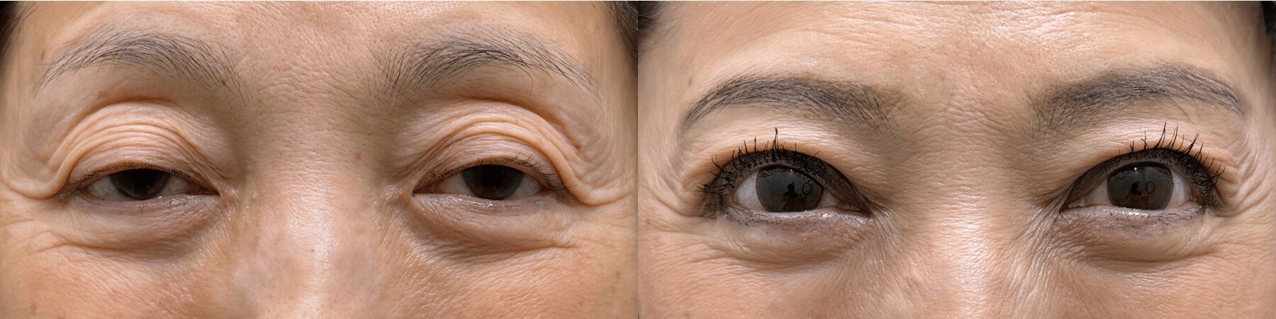 ベスト症例写真