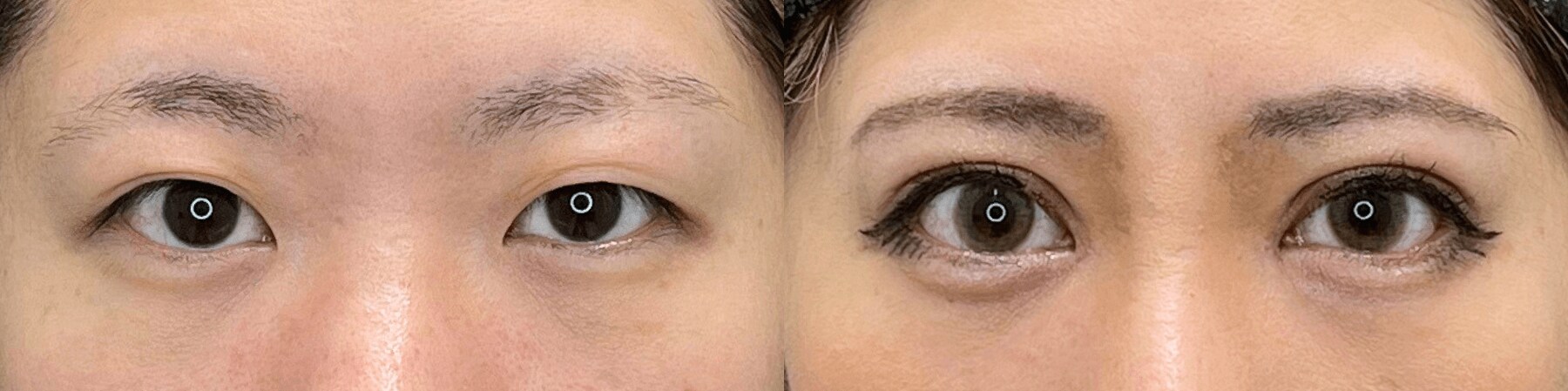 ベスト症例写真