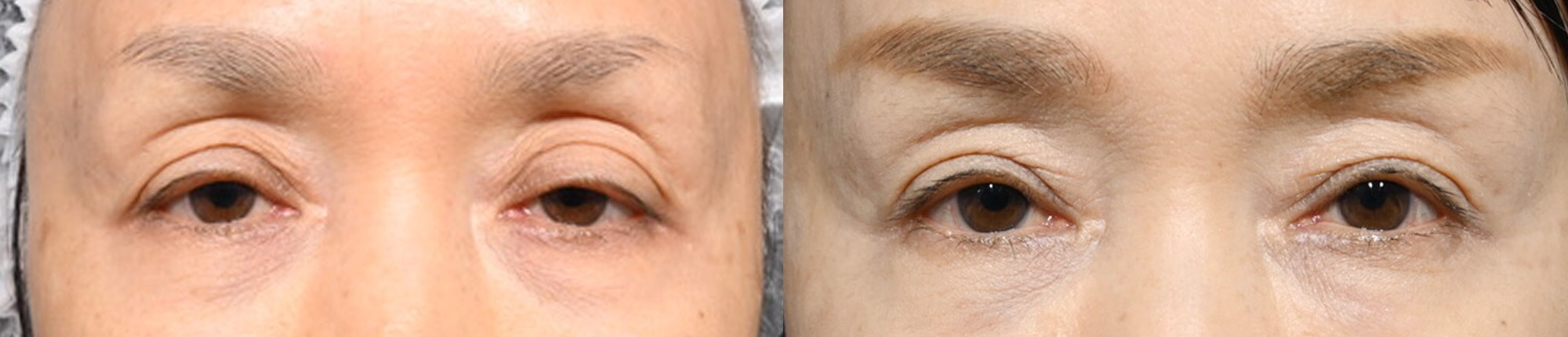 ベスト症例写真