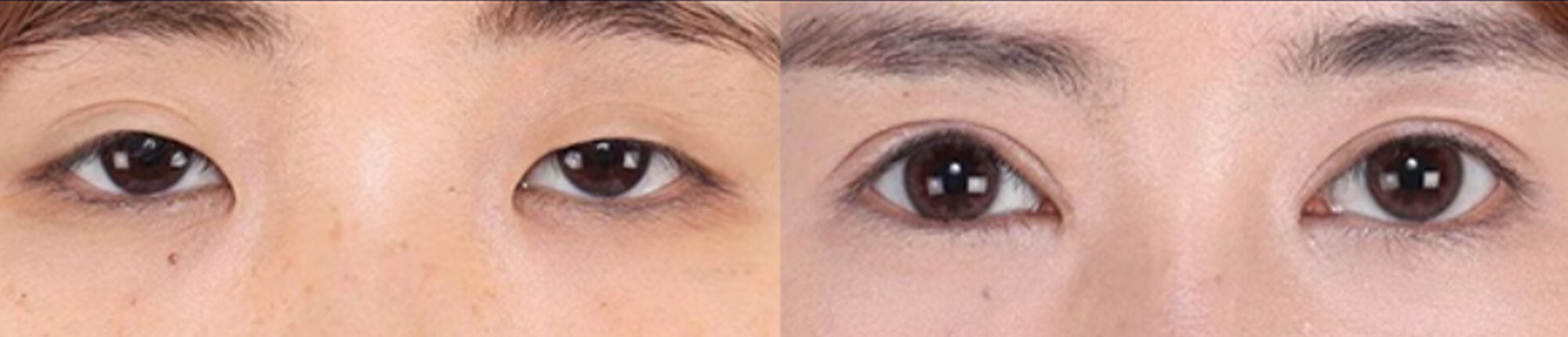 ベスト症例写真