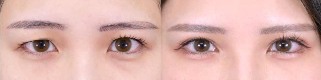 ベスト症例写真