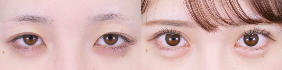 ベスト症例写真