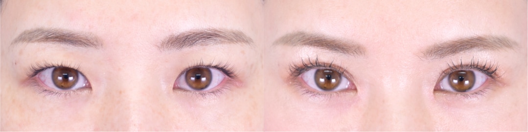 ベスト症例写真