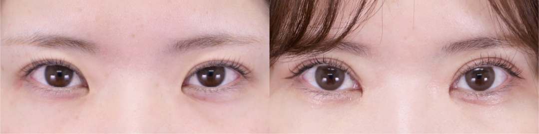 ベスト症例写真