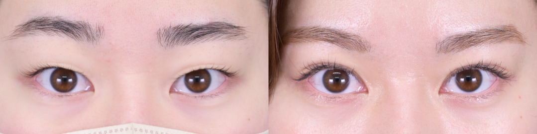 ベスト症例写真