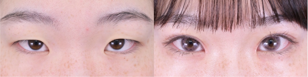 ベスト症例写真