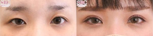 ベスト症例写真