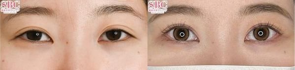 ベスト症例写真