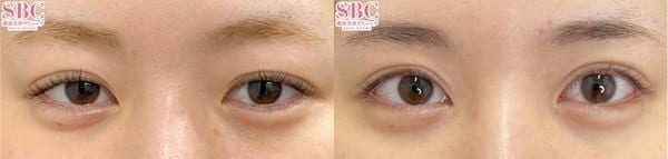 ベスト症例写真