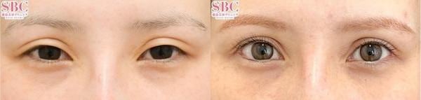 ベスト症例写真