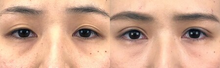 ベスト症例写真