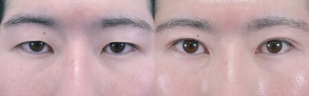 ベスト症例写真