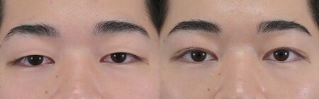 ベスト症例写真