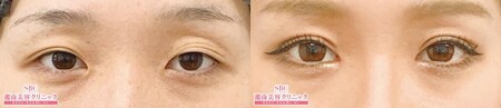 ベスト症例写真