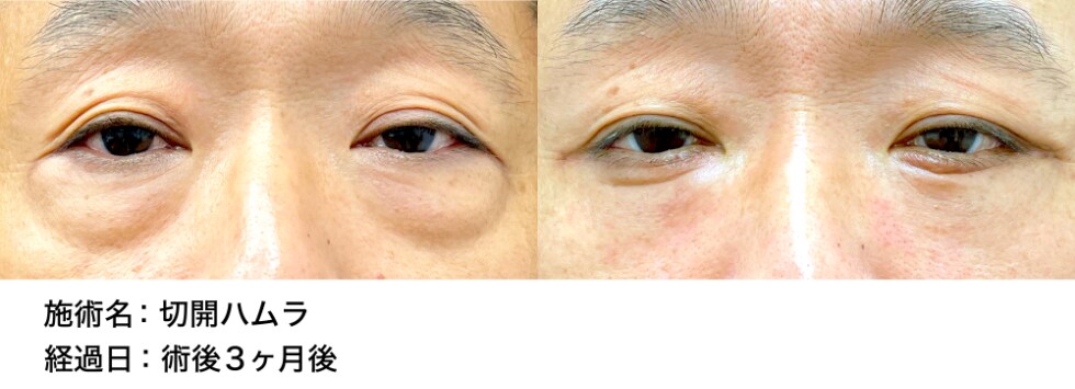 ベスト症例写真