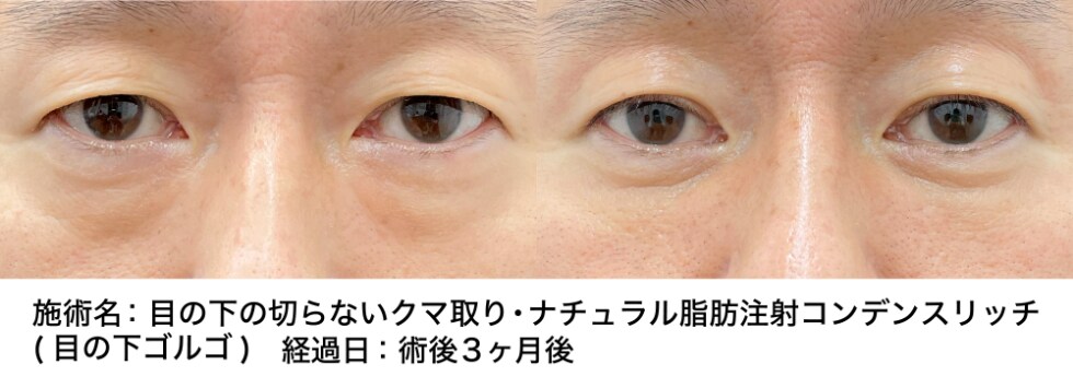 ベスト症例写真