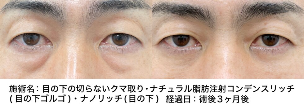 ベスト症例写真