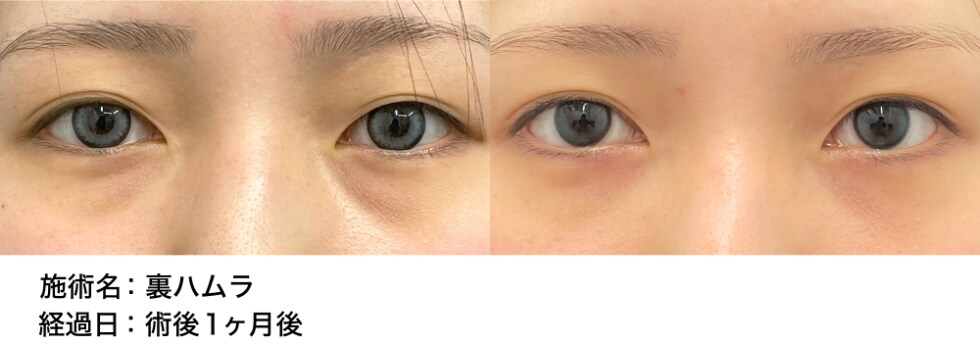 ベスト症例写真