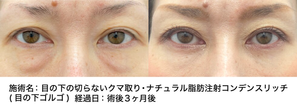 ベスト症例写真