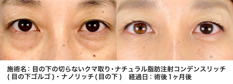 ベスト症例写真