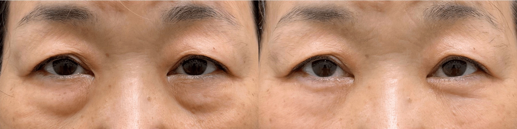 ベスト症例写真